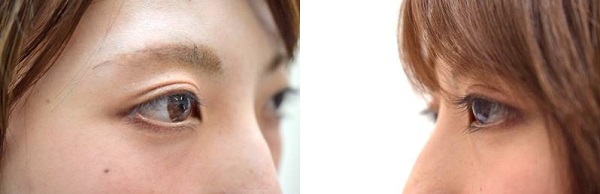 まつげ美容液エターナルアイラッシュの効果は?